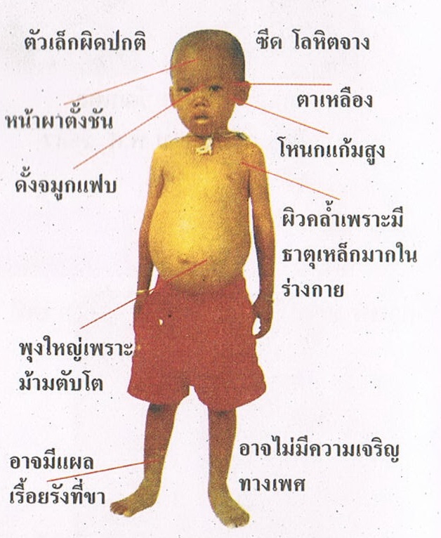 ธาลัส1.jpg